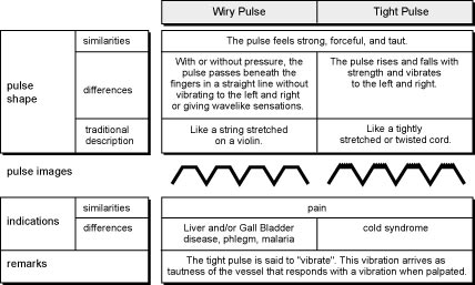 Comparison of Wiry and Tight Pulses
