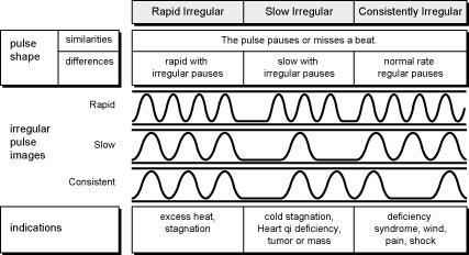 Comparison of Rapid, Slow, and Consistently Irregular Pulses